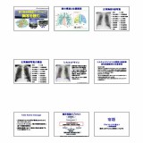 【第26回】2013/11/7 胸部写真の読み方について シルエットサインの見方を勉強した。地域医療で最も有用かつ必要とされるノウハウである。胸部写真における様々なラインについて、さらにはそれと接する場所が肺のどの部分にあたるかについて話し合った。.