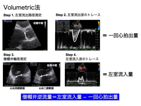 volumetric法