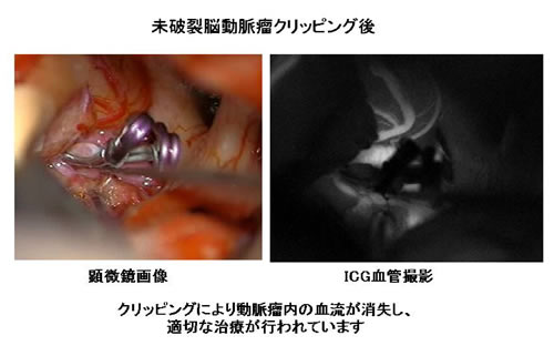 satsuei02