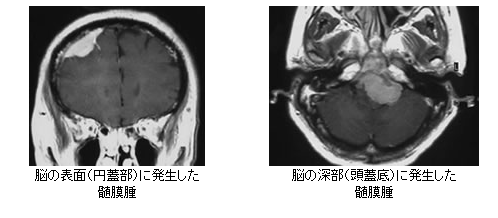 neuroimage201409