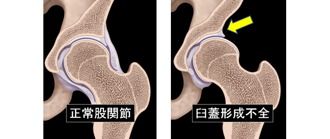 股関節部門概要 臨床部門 部門紹介 人工関節センター 愛媛大学医学部附属病院