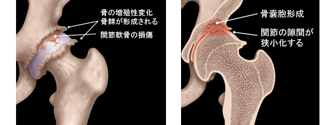 股関節部門概要 臨床部門 部門紹介 人工関節センター 愛媛大学医学部附属病院