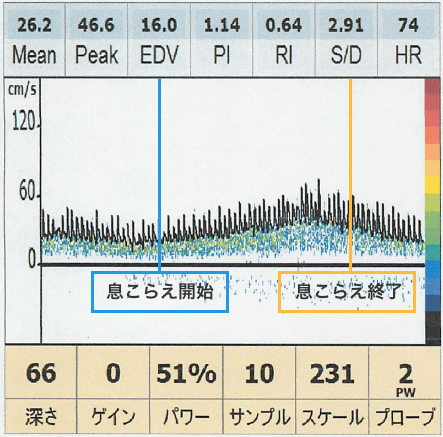 グラフ：息こらえ開始から息こらえ終了まで