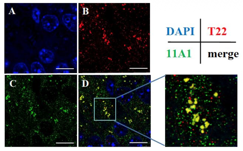 図2：糖尿病3xTg-ADマウス脳におけるAβ42とp-tauの共凝集。(A) DAPI、(B) T22、(C) 11A1、(D) 融合像の蛍光免疫染色