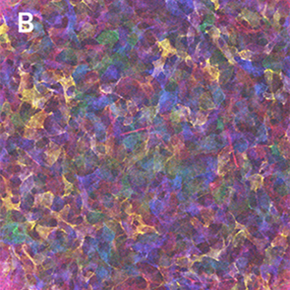 画像：マウス角膜実質細胞であるケラトサイトを4種類の蛍光蛋白で10色に描出