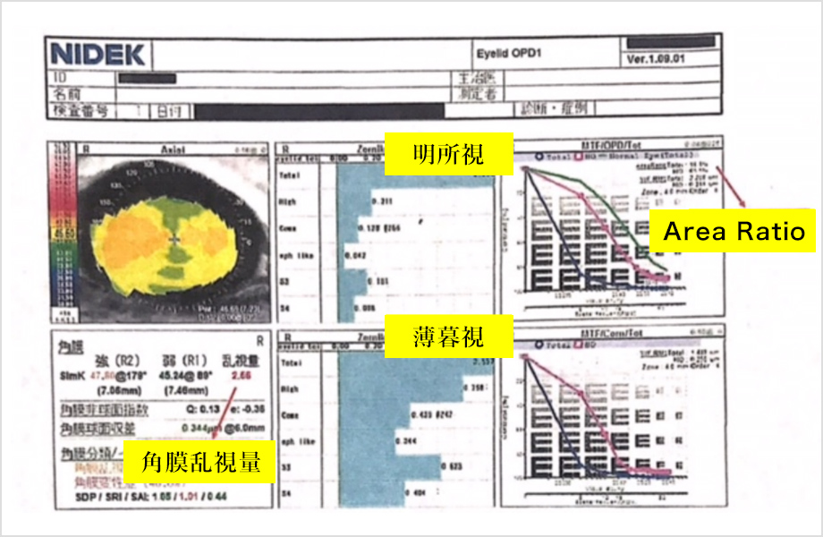 画像：角膜形状、高次収差解析OPDⅢ(NIDEK社)結果