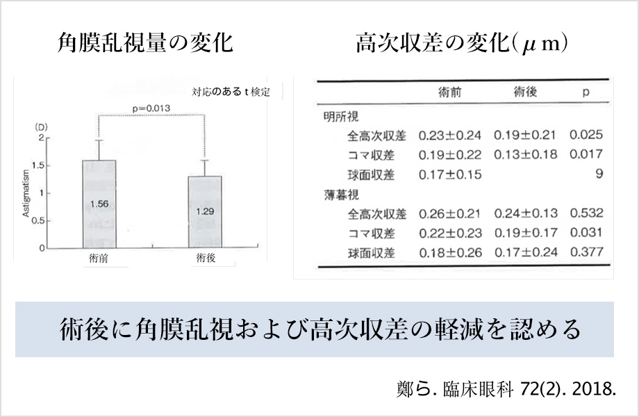 画像：眼瞼下垂手術前後での角膜乱視・収差の変化