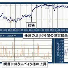 緑内障の研究