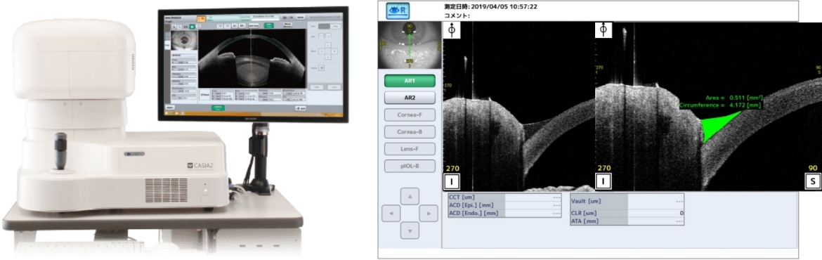 前眼部OCTを用いた涙液の断面図撮影