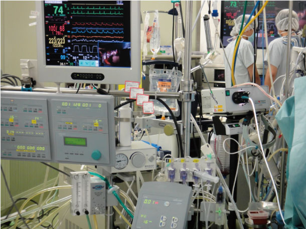 心臓血管外科（小児心臓手術） | 愛媛大学大学院医学系研究科心臓血管 