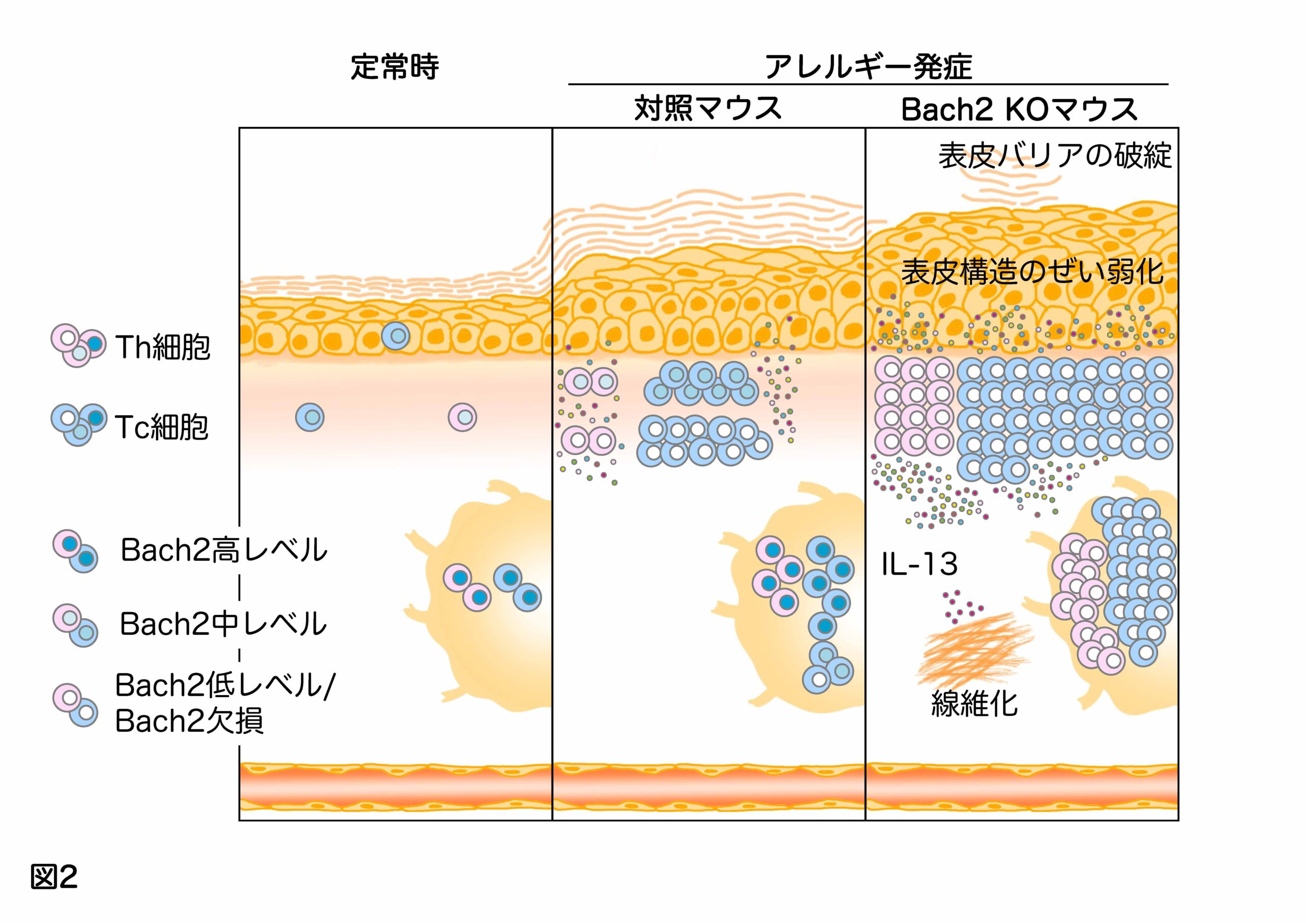 アトピー性皮膚炎を長びかせるリンパ球の特徴とは？